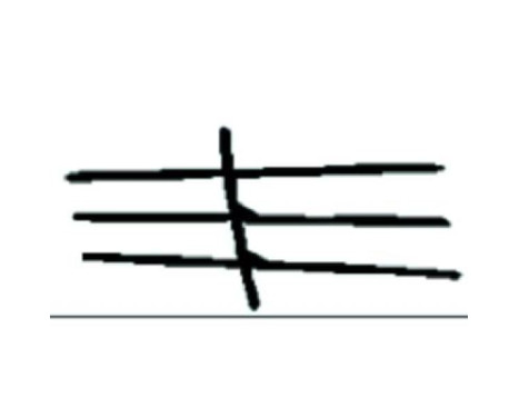 Decorative / Protection panel, radiator grille