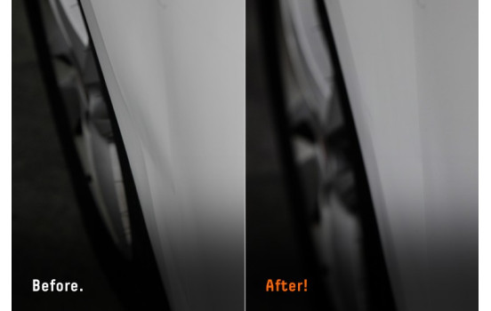 Quixx DIY Dent Set, Image 5