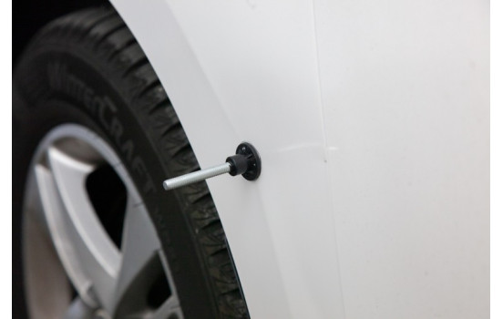 Quixx DIY Dent Set, Image 3