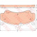 Brake Pad Set, disc brake GDB1779 TRW