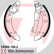Bromsbackar, sats, miniatyr 2