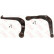 Ensemble de dents de fer SET_JTC949_JTC950 TRW
