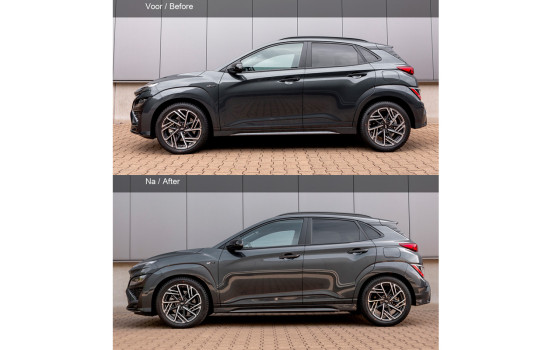 H&R Lowering springs suitable for Hyundai Kona 2017- 1.0 T-GDI (2WD) incl. Mild-Hybrid & N-Line VA30/, Image 3