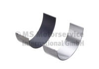 Conrod Stabiliser Set