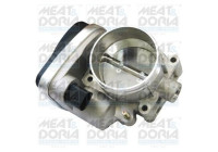 Throttle body