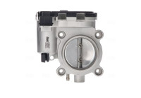Throttle body