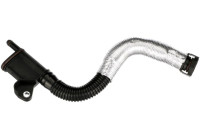 Slang, vevhusventilation