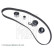 Kit de distribution ADG07323 Blue Print, Vignette 2