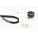 Kit de distribution CT847K1 Contitech, Vignette 5