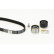 Kit de distribution CT987K2 Contitech, Vignette 5