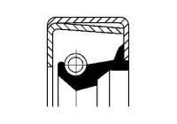 Bague d'étanchéité, différentiel