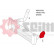 Gaine de suralimentation, Vignette 2