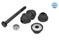 Barra estabilizadora