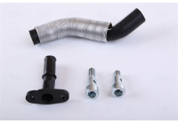 Turbocompresseur, kit de montage