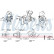 Turbocompresseur, suralimentation
