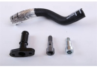 Turbocompresseur, kit de montage